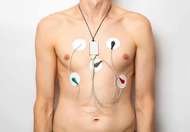 holter-cardiaco